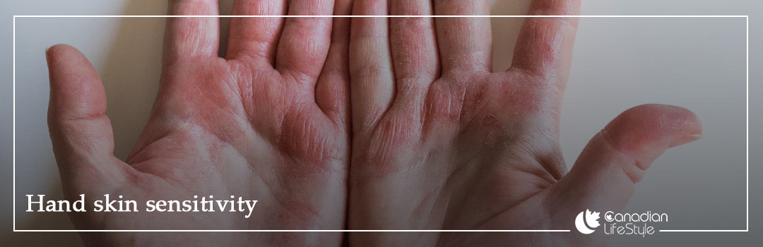 Causes of Hand Skin Sensitivity