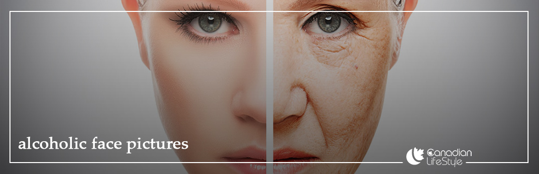 alcoholic face pictures